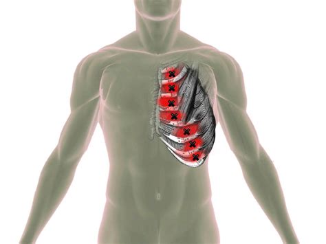 <strong>Spasms</strong> may cause minor to severe symptoms, including difficulty swallowing and chest pain. . Muscle spasm in ribs under breast